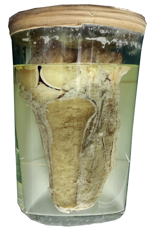 Препарат анатомічний, виготовлений М. І. Пироговим