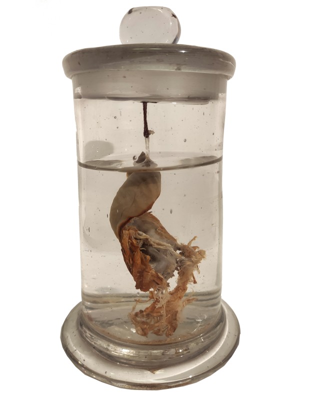 Препарат анатомічний, виготовлений М. І. Пироговим