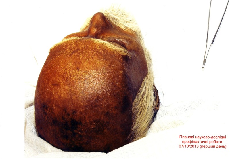 Фото. Автор - Кланца О.П. Планові науково-профілактичні роботи зі збереження набальзамованого тіла М. І. Пирогова 07.10.2013 р. Зовнішній вигляд голови М. І. Пирогова у проєкції зверху.