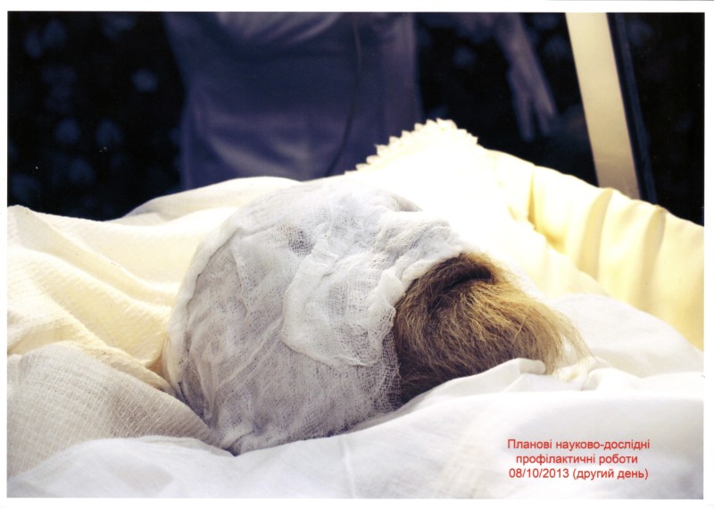 Фото. Автор - Кланца О.П. Планові науково-профілактичні роботи зі збереження набальзамованого тіла М. І. Пирогова 08.10.2013 р. Аплікація бальзамуючого розчину на тканини голови.