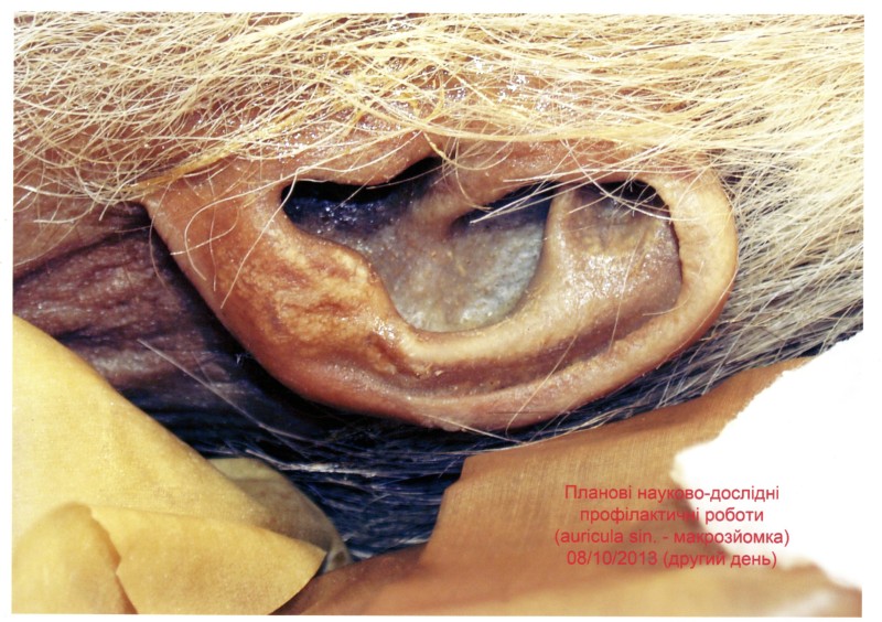 Фото. Автор - Кланца О.П. Планові науково-профілактичні роботи зі збереження набальзамованого тіла М. І. Пирогова 08.10.2013 р. Зображення лівої вушної раковини (макрозйомка).