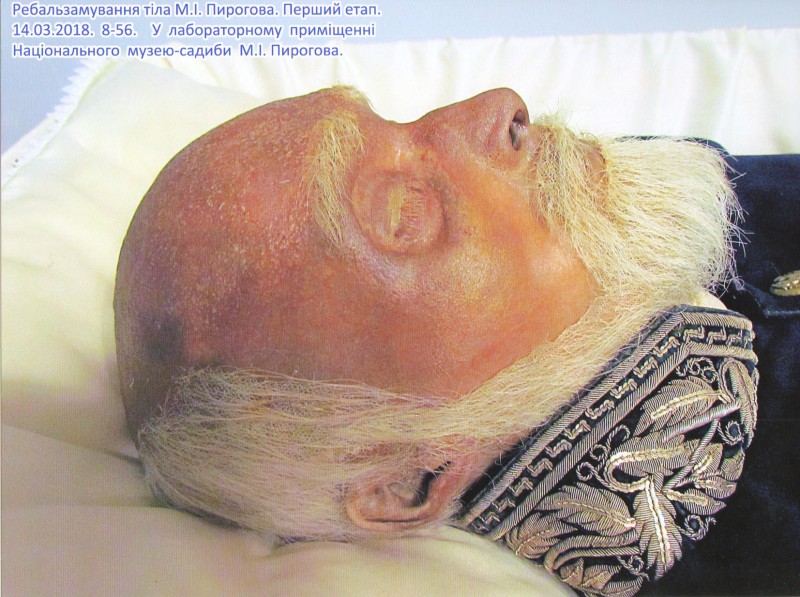 Фотографія. Ребальзамування тіла М.І.Пирогова. Перший етап. 14.03.2018. 8-56. У лабораторному приміщенні Національного музею-садиби М.І.Пирогова.