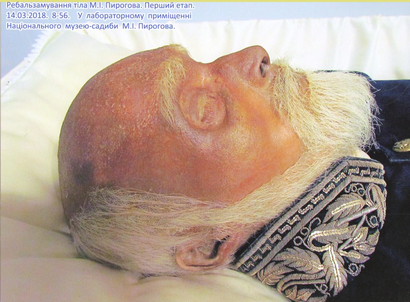 Фотографія. Ребальзамування тіла М.І.Пирогова. Перший етап. 14.03.2018. 8-56. У лабораторному приміщенні Національного музею-садиби М.І.Пирогова.