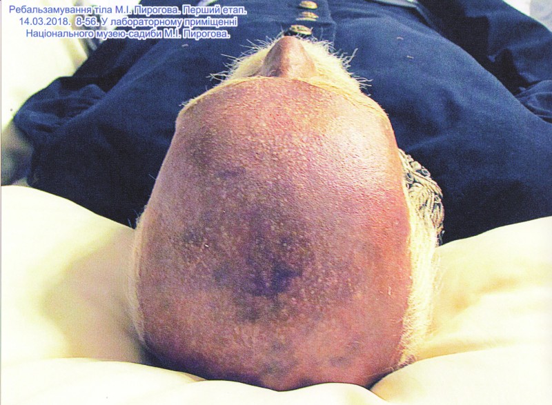 Фотографія. Ребальзамування тіла М.І.Пирогова. Перший етап. 14.03.2018. 8-56. У лабораторному приміщенні Національного музею-садиби М.І.Пирогова.