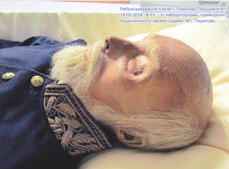 Фотографія. Ребальзамування тіла М.І.Пирогова. Перший етап. 14.03.2018. 8-55. У лабораторному приміщенні Національного музею-садиби М.І.Пирогова.