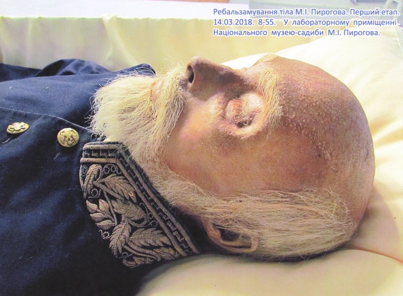 Фотографія. Ребальзамування тіла М.І.Пирогова. Перший етап. 14.03.2018. 8-55. У лабораторному приміщенні Національного музею-садиби М.І.Пирогова.