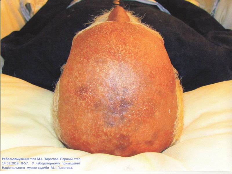 Фотографія. Ребальзамування тіла М.І.Пирогова. Перший етап. 14.03.2018. 8-57. У лабораторному приміщенні Національного музею-садиби М.І.Пирогова.